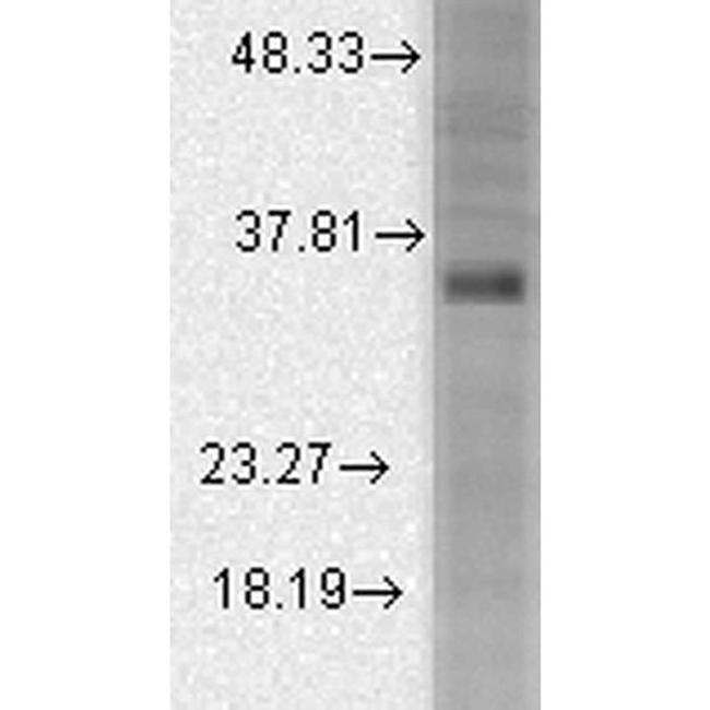 KCNMB3 Antibody in Western Blot (WB)