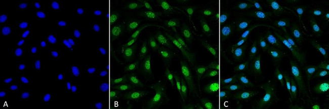 MDC1 Antibody in Immunocytochemistry (ICC/IF)