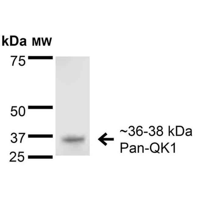 QKI Antibody in Western Blot (WB)