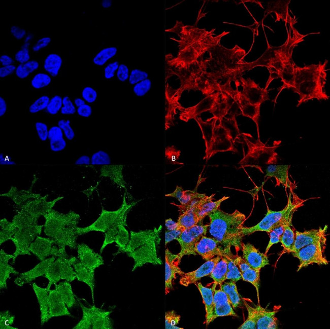 LGI1 Antibody in Immunocytochemistry (ICC/IF)