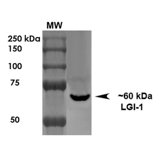 LGI1 Antibody in Western Blot (WB)