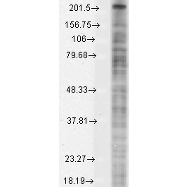 SCN10A Antibody in Western Blot (WB)