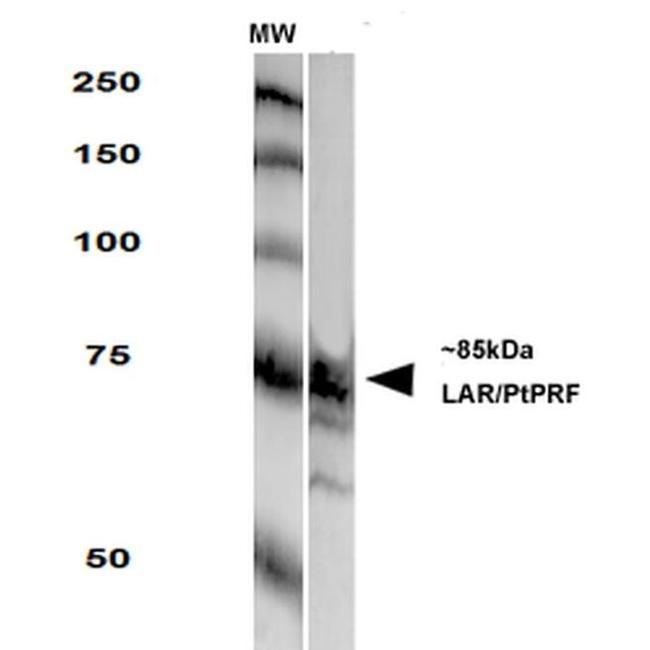 PTPRF Antibody in Western Blot (WB)