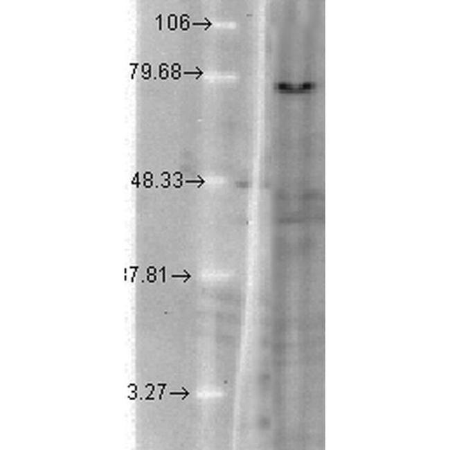 KCNQ1 Antibody in Western Blot (WB)