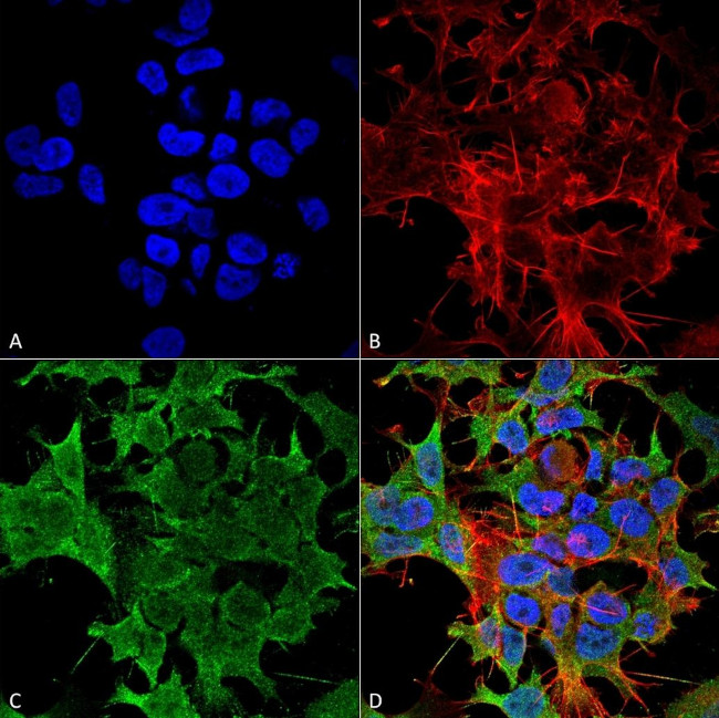 KCNK3 Antibody in Immunocytochemistry (ICC/IF)