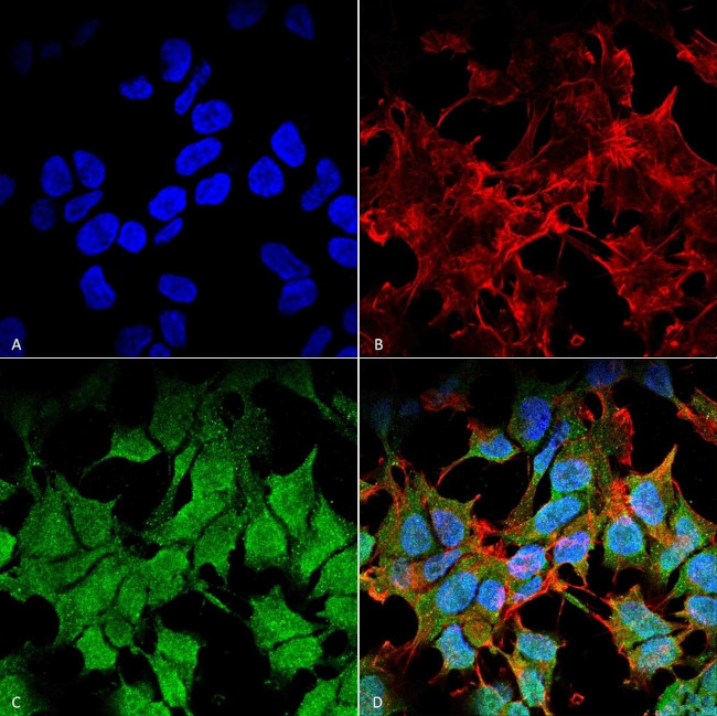 Kir6.1 (KCNJ8) Antibody in Immunocytochemistry (ICC/IF)