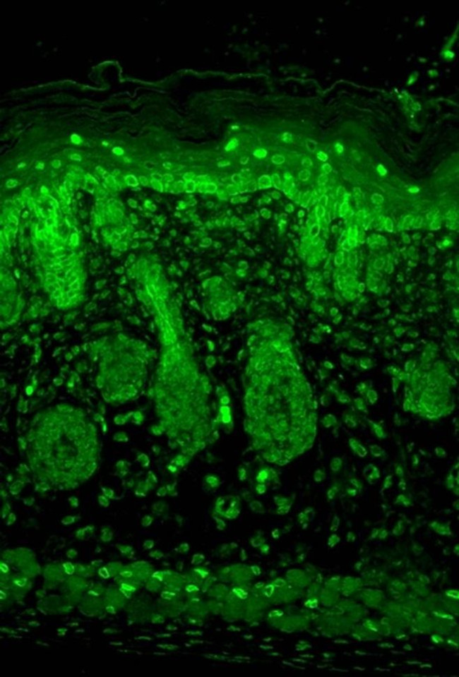 Kir2.1 (KCNJ2) Antibody in Immunohistochemistry (Paraffin) (IHC (P))