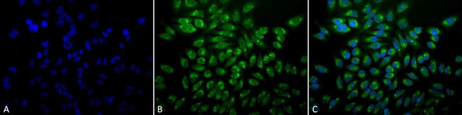 GRP78 Antibody in Immunocytochemistry (ICC/IF)