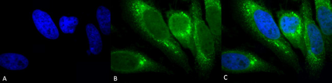 GRP78 Antibody in Immunocytochemistry (ICC/IF)