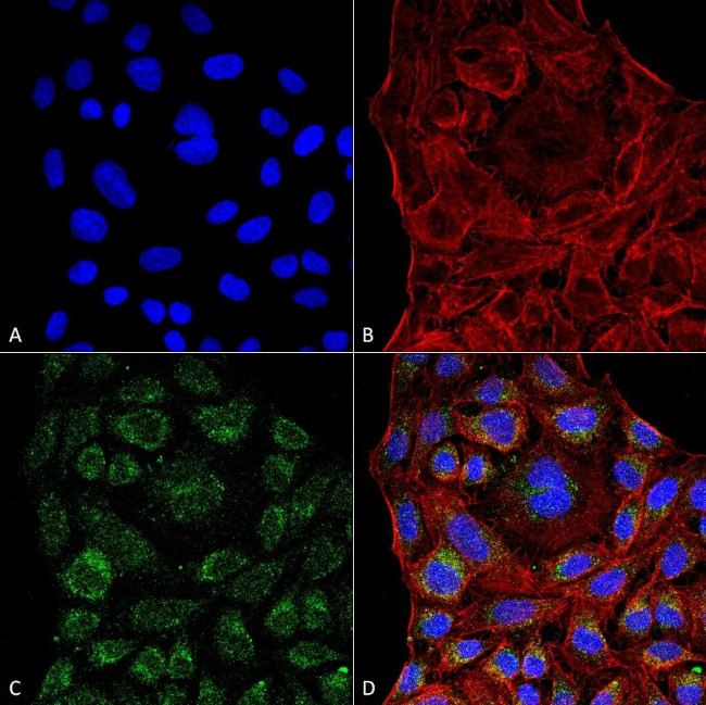 ERp57 Antibody in Immunocytochemistry (ICC/IF)