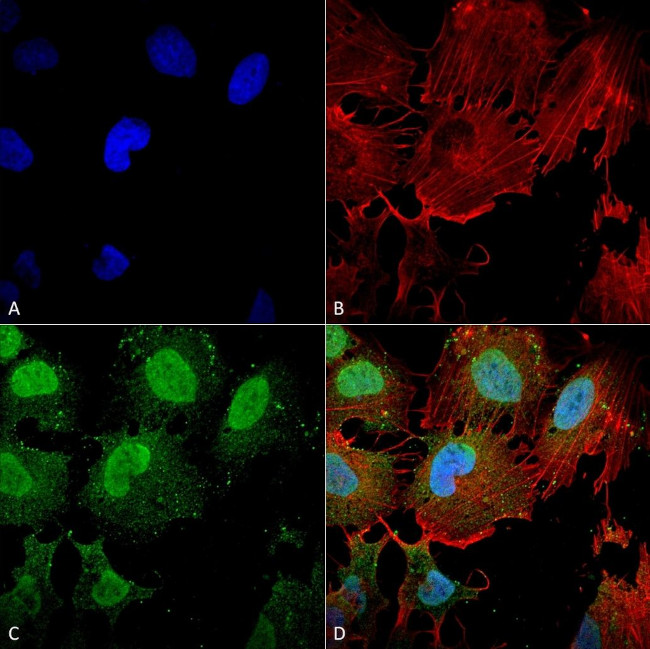 mGluR5 Antibody in Immunocytochemistry (ICC/IF)