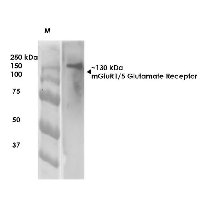 mGluR5 Antibody in Western Blot (WB)