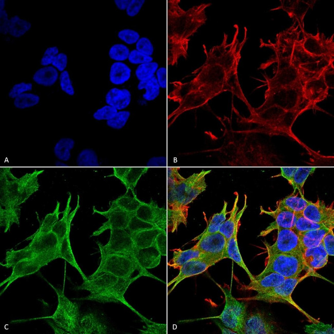 NMDAR2A Antibody in Immunocytochemistry (ICC/IF)