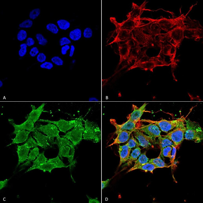 GABRE Antibody in Immunocytochemistry (ICC/IF)