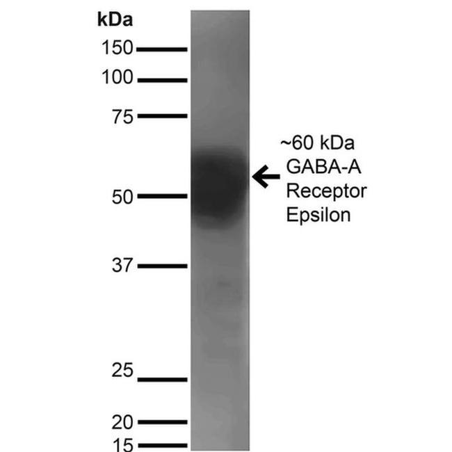 GABRE Antibody in Western Blot (WB)