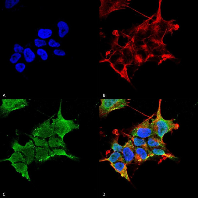 GABRA4 Antibody in Immunocytochemistry (ICC/IF)