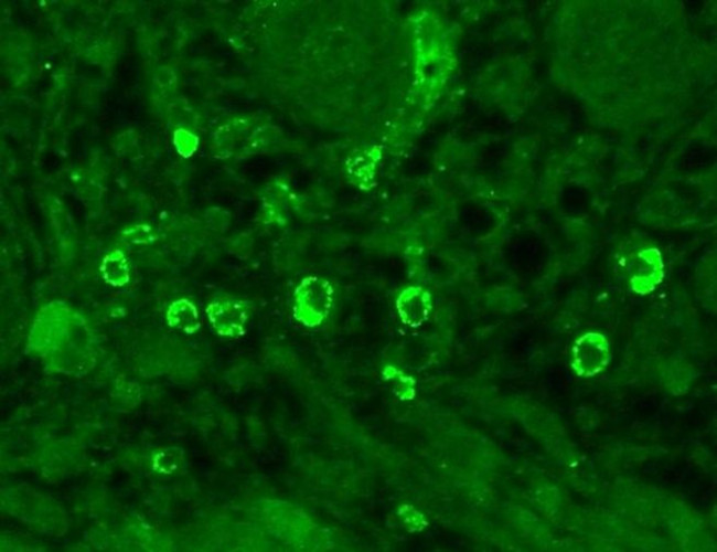 GABRA1 Antibody in Immunohistochemistry (Paraffin) (IHC (P))