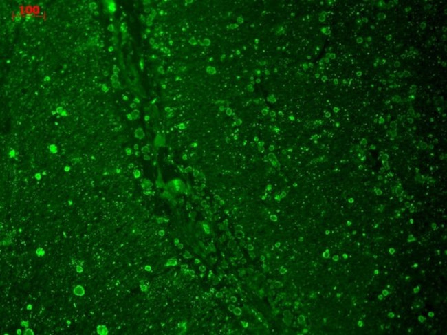 CaV1.2 Antibody in Immunohistochemistry (Paraffin) (IHC (P))