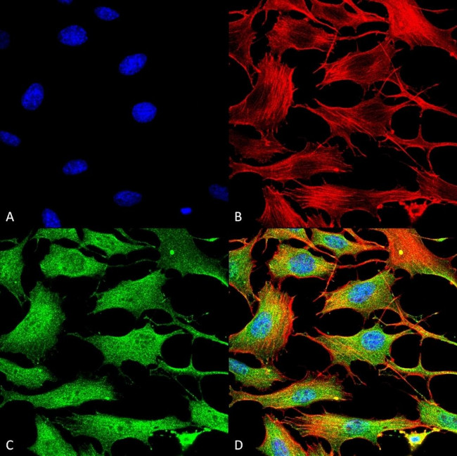 ATP7B Antibody in Immunocytochemistry (ICC/IF)