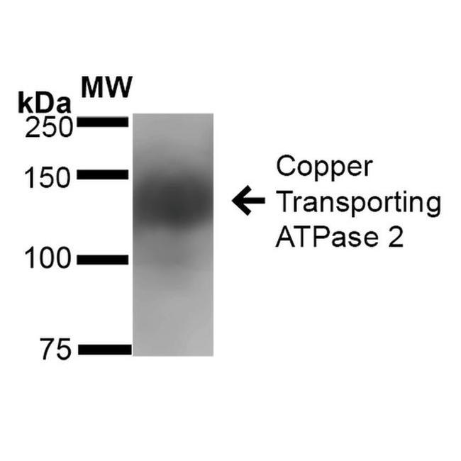 ATP7B Antibody in Western Blot (WB)