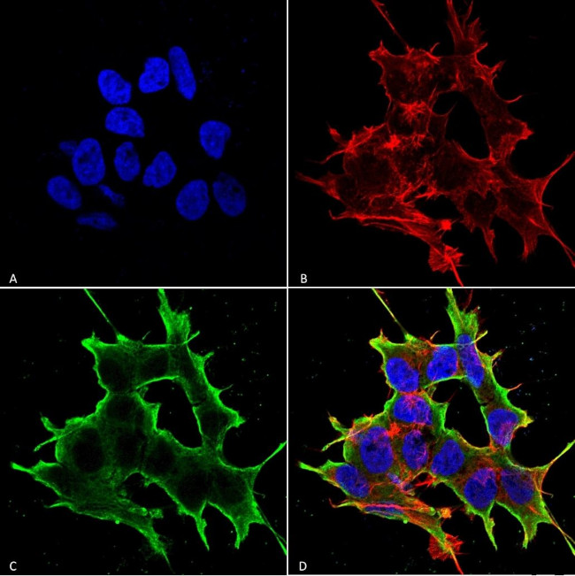 ATF4 Antibody in Immunocytochemistry (ICC/IF)