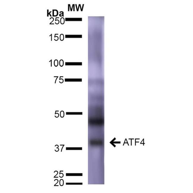 ATF4 Antibody in Western Blot (WB)