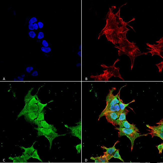 Ankyrin 1 Antibody in Immunocytochemistry (ICC/IF)