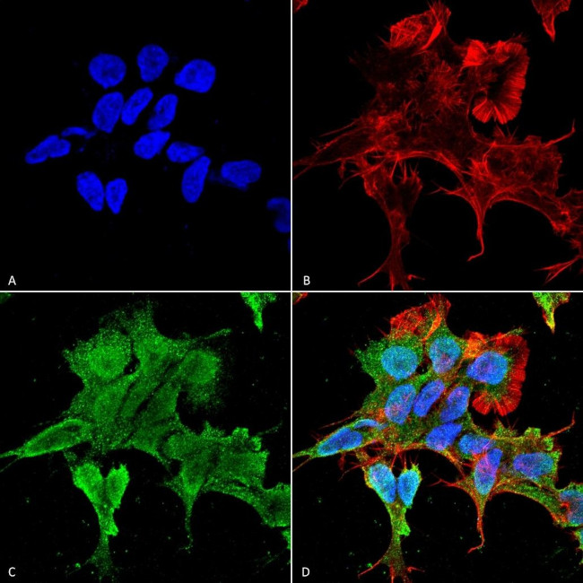 alpha-2c Adrenergic Receptor Antibody in Immunocytochemistry (ICC/IF)