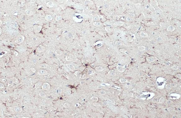 IBA1 Antibody in Immunohistochemistry (Paraffin) (IHC (P))