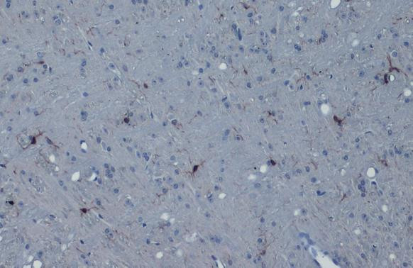 IBA1 Antibody in Immunohistochemistry (Paraffin) (IHC (P))