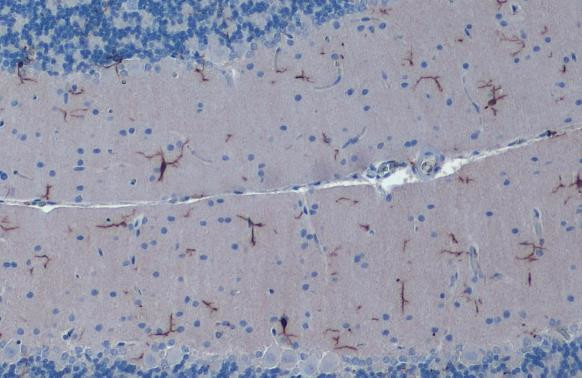 IBA1 Antibody in Immunohistochemistry (Paraffin) (IHC (P))