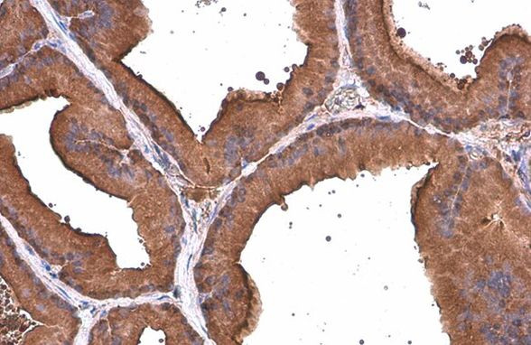 ALDH1A3 Antibody in Immunohistochemistry (Paraffin) (IHC (P))