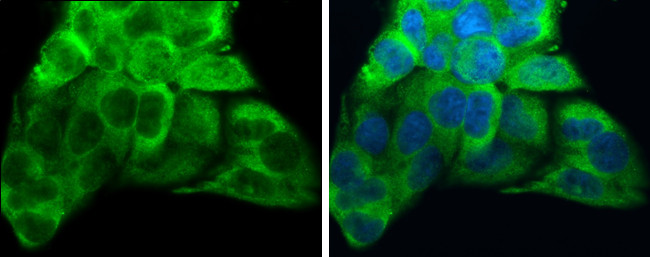 ATP6V1A Antibody in Immunocytochemistry (ICC/IF)