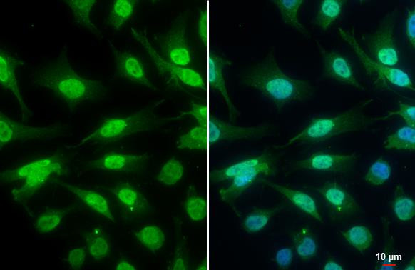 Phospho-ATR (Thr1989) Antibody in Immunocytochemistry (ICC/IF)