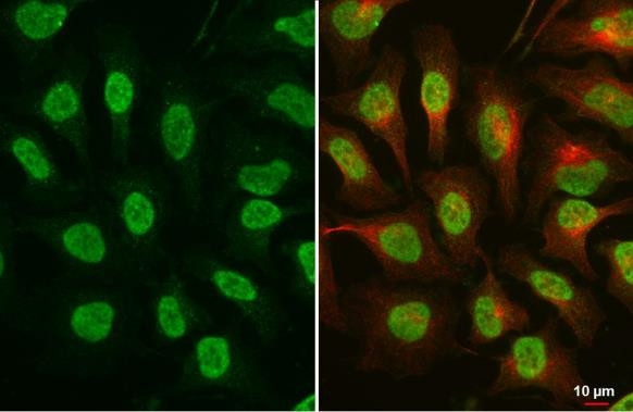 Phospho-ATR (Thr1989) Antibody in Immunocytochemistry (ICC/IF)