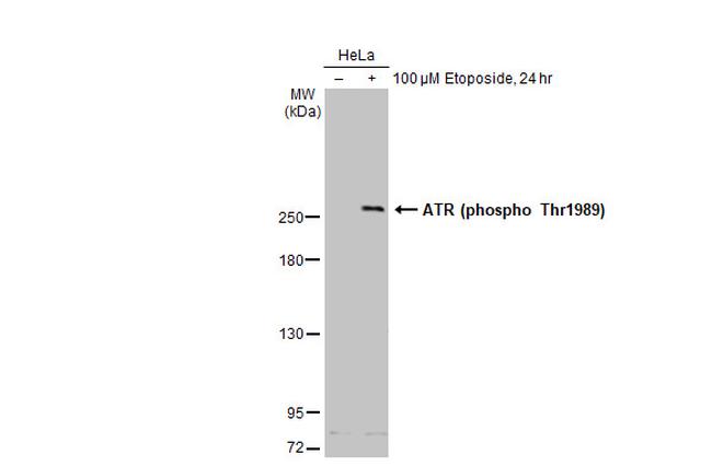 Phospho-ATR (Thr1989) Antibody in Western Blot (WB)