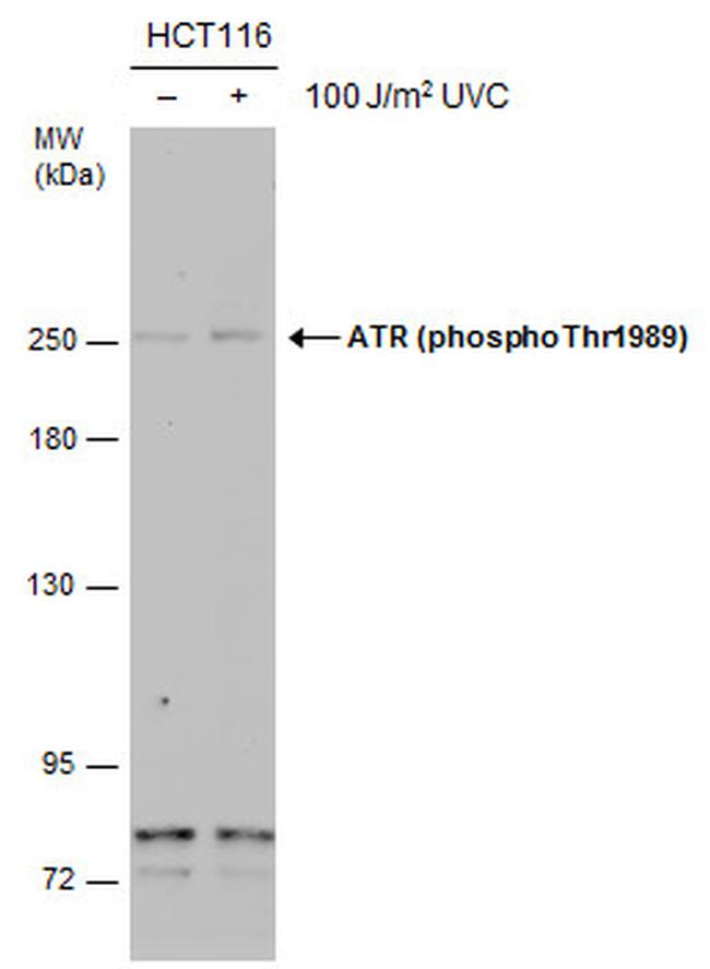 Phospho-ATR (Thr1989) Antibody in Western Blot (WB)