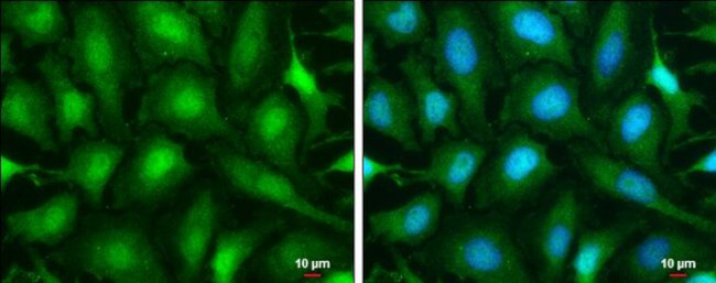 Phospho-ATR (Thr1989) Antibody in Immunocytochemistry (ICC/IF)