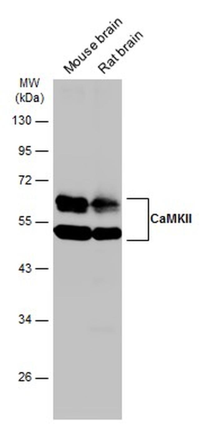 CaMKII delta Antibody in Western Blot (WB)