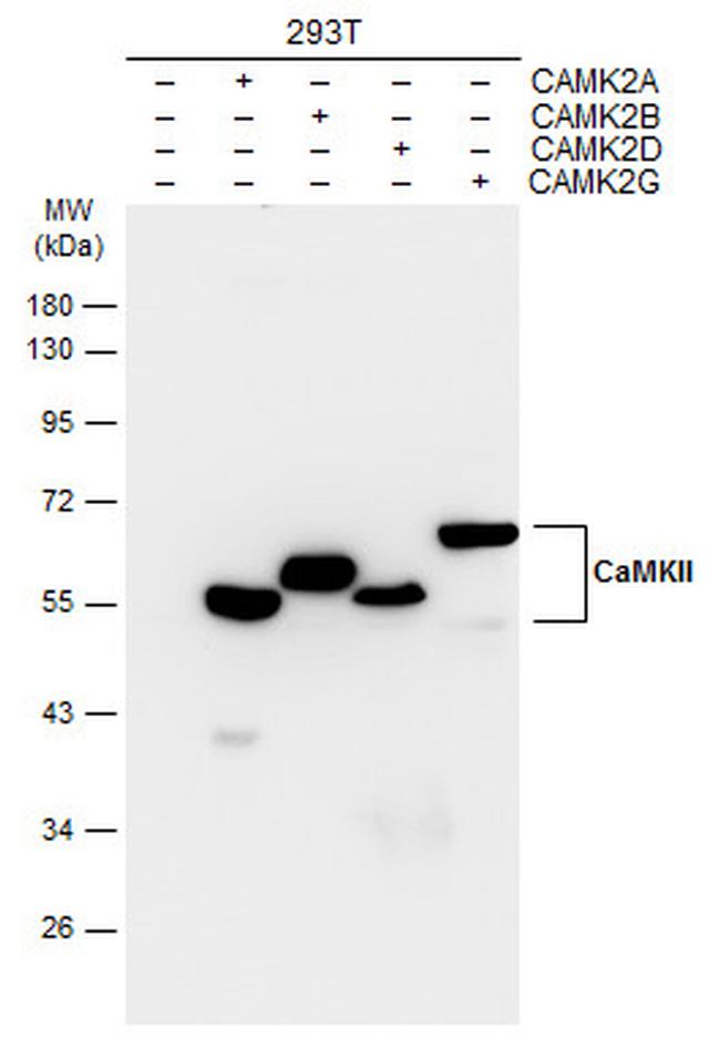 CaMKII delta Antibody in Western Blot (WB)