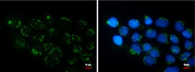 COL11A2 Antibody in Immunocytochemistry (ICC/IF)