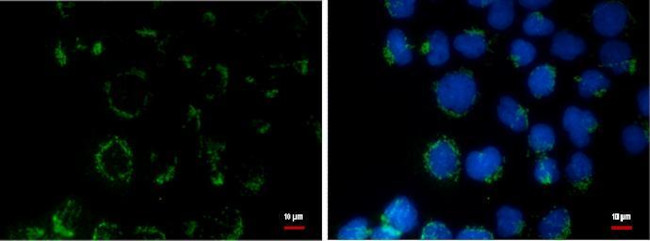 COL11A2 Antibody in Immunocytochemistry (ICC/IF)