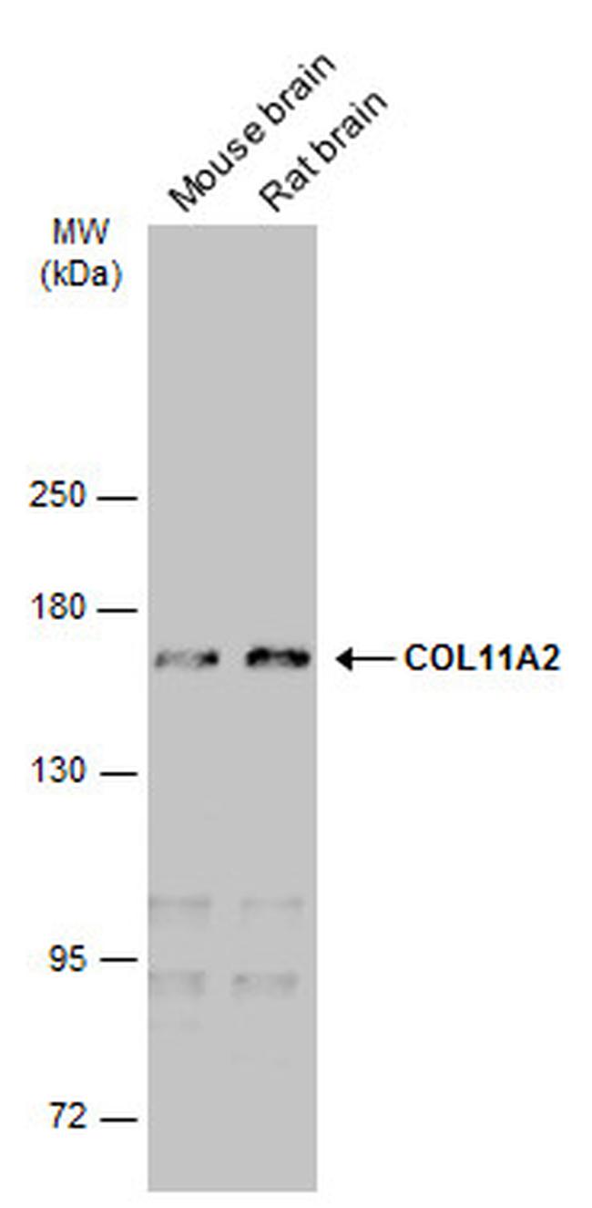 COL11A2 Antibody in Western Blot (WB)