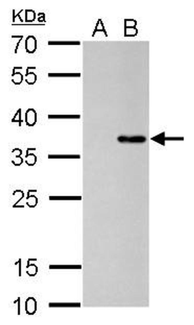 COL11A2 Antibody in Western Blot (WB)