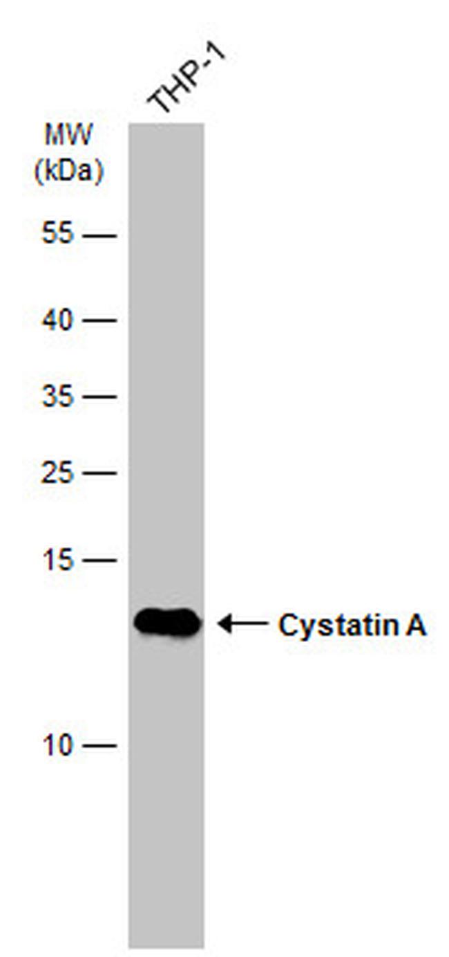 Cystatin A Antibody in Western Blot (WB)