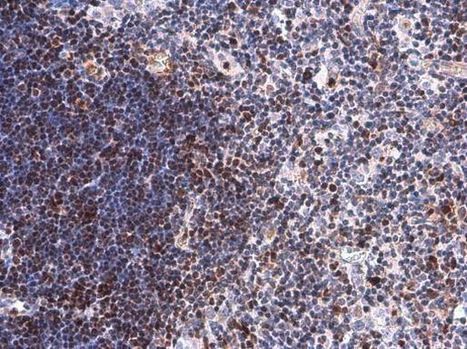 DCK Antibody in Immunohistochemistry (Paraffin) (IHC (P))