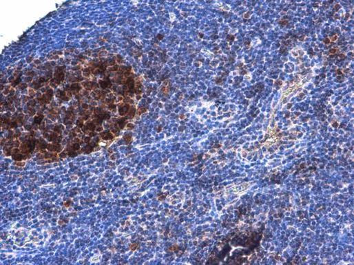 DCK Antibody in Immunohistochemistry (Paraffin) (IHC (P))