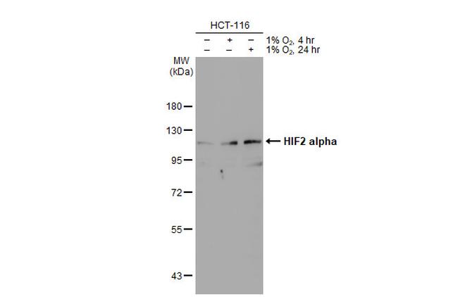 HIF-2 alpha Antibody in Western Blot (WB)