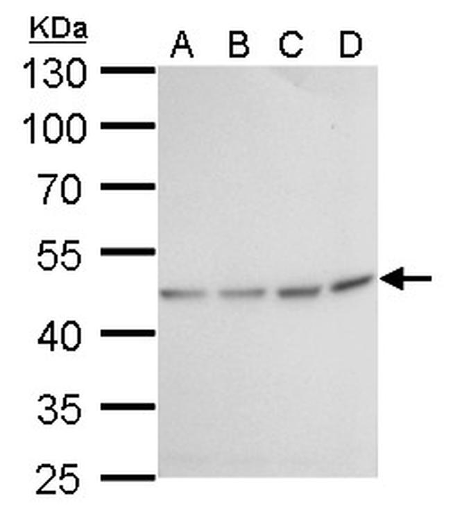 Fumarase Antibody in Western Blot (WB)