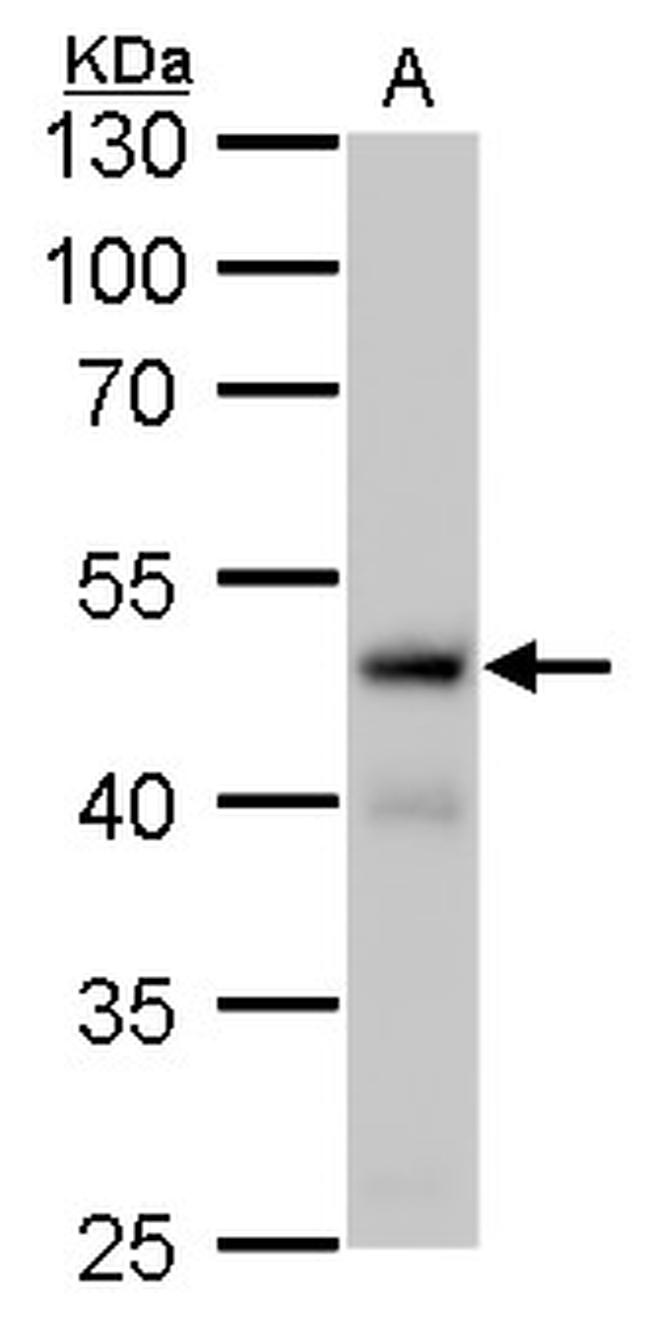 Fumarase Antibody in Western Blot (WB)